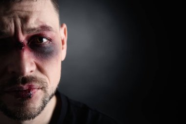 Koyu arka planda yüz yaralanması olan adamın yakın görüntüsü, mesaj için yer var. Aile içi şiddet mağduru