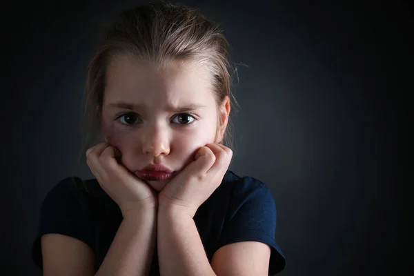 Kleines Mädchen Mit Blauen Flecken Gesicht Vor Dunklem Hintergrund Raum — Stockfoto