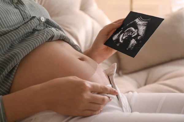 Giovane Donna Incinta Che Tiene Immagine Ecografica Vicino Alla Pancia — Foto Stock