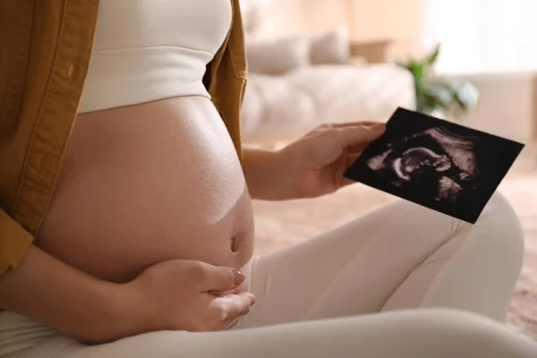 Zwangere Jonge Vrouw Houdt Echografie Foto Buurt Van Haar Buik — Stockfoto