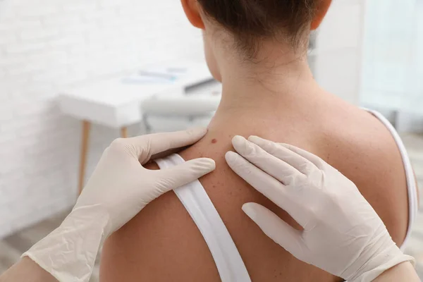 Dermatologe Untersucht Muttermal Des Patienten Klinik Nahaufnahme — Stockfoto