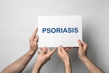 Işık arkaplanda PSORIASIS yazılı kart tutan erkekler, yakın plan 
