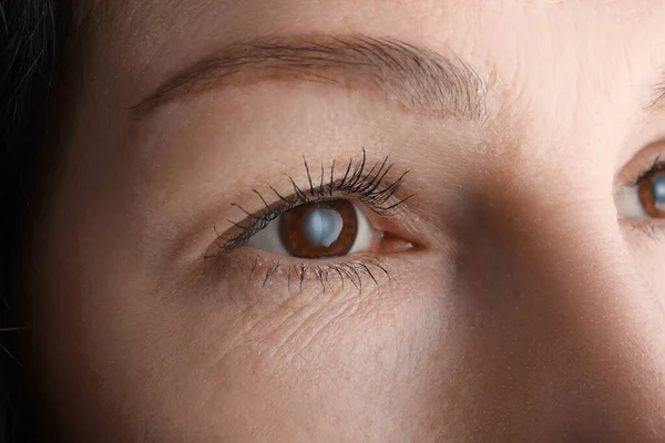 Vista Vicino Della Donna Matura Che Soffre Cataratta — Foto Stock