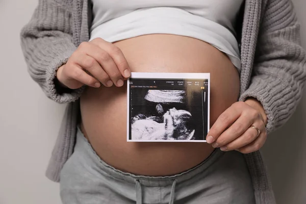 Junge Schwangere Frau Mit Ultraschallbild Des Babys Auf Grauem Hintergrund — Stockfoto