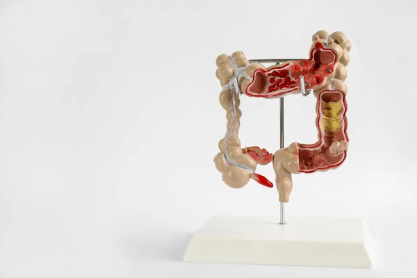 Модель Толстой Кишки Светлом Фоне Пространство Текста — стоковое фото