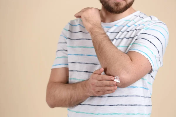 Mann Cremt Ellbogen Auf Beigem Hintergrund Ein Nahaufnahme Raum Für — Stockfoto