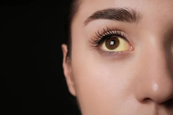 Mulher Com Olhos Amarelos Sobre Fundo Preto Close Espaço Para — Fotografia de Stock