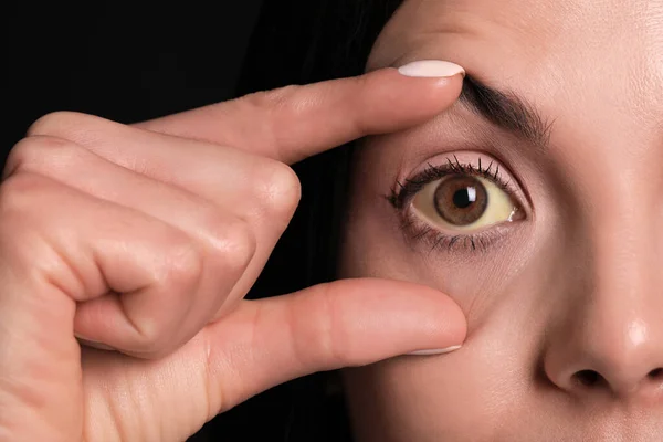黒を背景に健康状態を確認してる女性だ 肝臓の問題の症状として黄色の目 — ストック写真