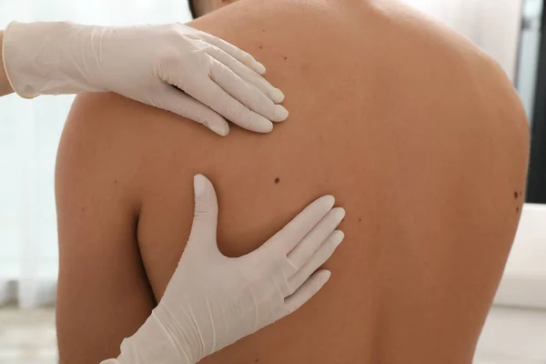 Dermatologista Examinando Marca Nascença Paciente Clínica Close — Fotografia de Stock