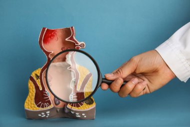 Proktolojist, anatomik rektum modelinin yanında açık mavi arka planda basurlu büyüteç tutuyor.