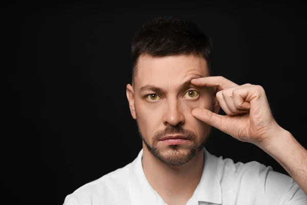 男人检查他的健康状况在黑色背景 文字的空间 黄眼睛是肝病的症状 — 图库照片