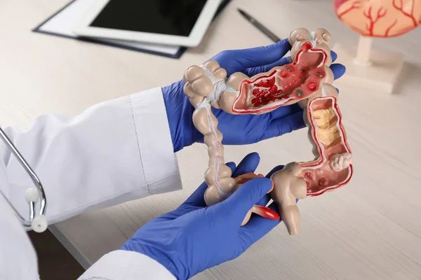 テーブルの上にヒトの結腸モデルを持つ消化器科医 クローズアップ — ストック写真