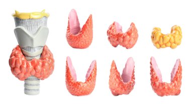 Beyaz arka planda sağlıklı ve hastalıklı tiroit modelleri, kolaj.