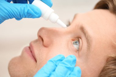 Doktor içerideki adamın gözüne tıbbi damlalar uyguluyor, yakın plan.