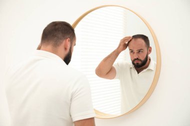 Kellik sorunu. Evinde aynanın yanında saçı dökülen bir adam var.