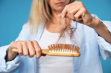 Alopecia sorunu. Kayıp saçlarını açık mavi arka plandaki fırçadan alan kadın, yakın plan.