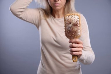 Alopecia sorunu. Gri arka planda saçları dökülmüş bir kadın, yakın plan.