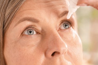 Bulanık arkaplanda göz damlası uygulayan kadın, yakın plan