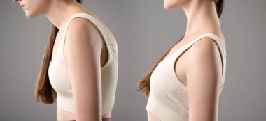 Kolajdan önce ve sonra gri arka plana karşı iyi ve kötü duruşu olan bir kadın görülüyor. Yakın plan.