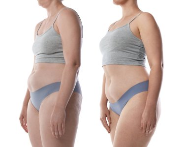 Kolajdan önce ve sonra beyaz arka plana karşı iyi ve kötü duruşu olan bir kadın görülüyor.