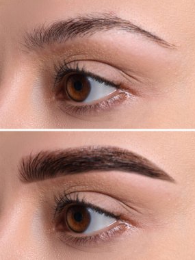 Kolaj, kaş düzeltme. Tedavi öncesi ve sonrası kadın fotoğrafları, yakın plan.