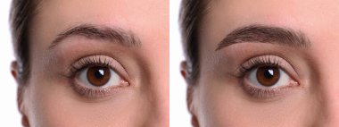 Kolaj, kaş düzeltme. Tedavi öncesi ve sonrası kadın fotoğrafları, yakın plan.