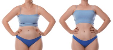 Kolajdan önce ve sonra beyaz arka plana karşı iyi ve kötü duruşu olan bir kadın görülüyor.