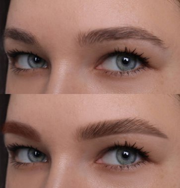 Kolaj, kaş düzeltme. Tedavi öncesi ve sonrası kadın fotoğrafları, yakın plan.