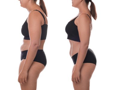 Kolajdan önce ve sonra beyaz arka plana karşı iyi ve kötü duruşu olan bir kadın görülüyor.