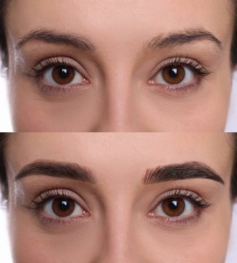 Kolaj, kaş düzeltme. Tedavi öncesi ve sonrası kadın fotoğrafları, yakın plan.