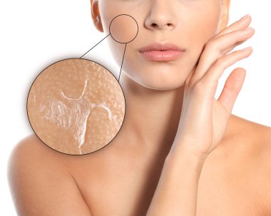 Yanak bölgesinde kurumuş pullu deri görünüyor. Beyaz arka plandaki kadın, yakın plan.