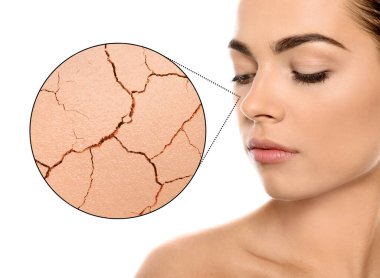 Yanağı büyümüş, derisi çatlamış. Beyaz arka planda güzel bir kadın