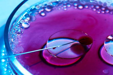 Tüp bebek tedavisinde. Açık mavi arka planda sıvı numuneli iğne ve petri kabı, yakın plan.