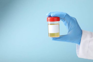 Açık mavi zemin üzerinde idrar örneği olan plastik bir kap tutan doktor, yakın plan. Metin için boşluk