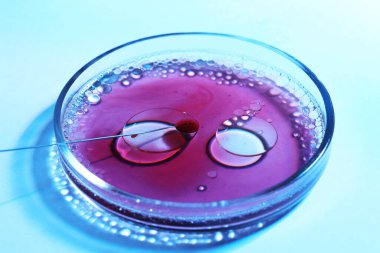 Tüp bebek tedavisinde. Açık mavi arka planda sıvı numuneli iğne ve petri kabı, yakın plan.