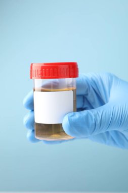 Açık mavi zemin üzerinde idrar örneği olan plastik kabı tutan doktor, yakın plan.