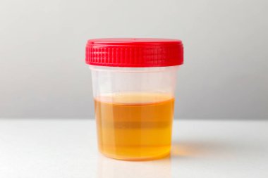 Beyaz masa üzerinde idrar örneği olan plastik kap, yakın plan.