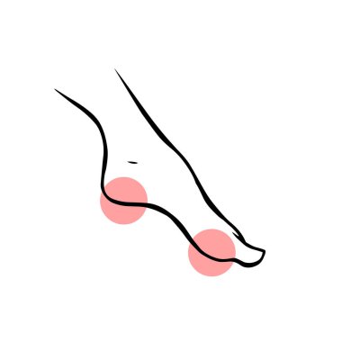 Topuk ağrısı olan bir bacak. Ortopedik hastalık plantar fasiiti. Vektör izole edilmiş taslak çizimi