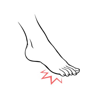 Topuk ağrısı olan bir bacak. Ortopedik hastalık. Ayak sağlığı sorunları. Vektör izole edilmiş taslak çizim eli