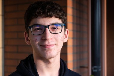 Ergenlik çağındaki caicasic bir çocuğun portresi: yüz derisinde küçük sivilceleri, kırmızı noktaları, sivilceleri tanıyabiliriz..