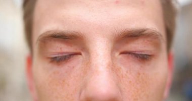 Yeşil gözlerini açıp kameraya bakan çilli adamın görüntüsünü kaybet..