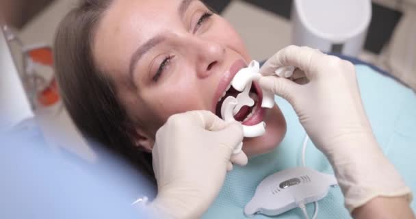 El dentista instala un retractor labial para el paciente. Procedimiento cosmético de belleza en una clínica dental. Blanqueamiento dental — Vídeo de stock