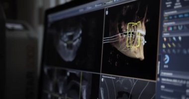 Modern bir diş kliniğinde çene MR 'ı. Hastaların röntgen taramasında MRI görüntüsü. Modern dişçilikte teşhis medikal ekipmanları