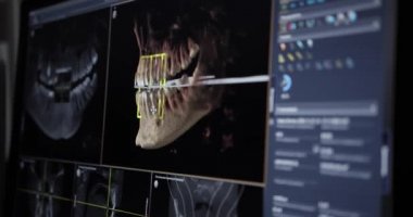 Stomatoloji dişçisi araştırmaları için insan çenesinin gerçek yaşam MRI taraması yeni kaliteli tıbbi bilimler diş görüntüsü canlandırma ekranı