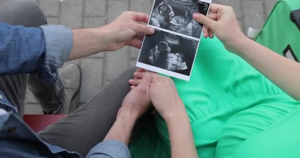 Close-up top view of a woman showing an ultrasound image to her husband. A couple in love is expecting a baby — Stock Video