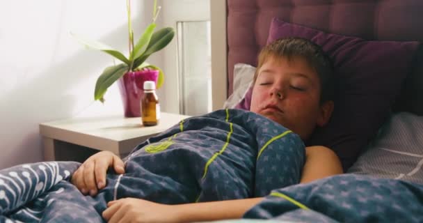 Penyakit virus. Wabah campak. Anak dengan infeksi virus campak terletak di tempat tidur dan batuk berat — Stok Video