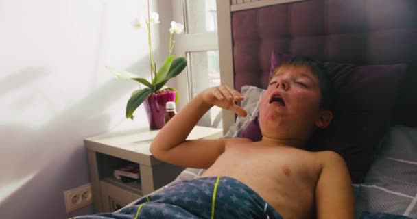 Malattia virale. Morbido rash. Bambino con infezione virale morbillo si trova nel letto e tosse pesante — Video Stock