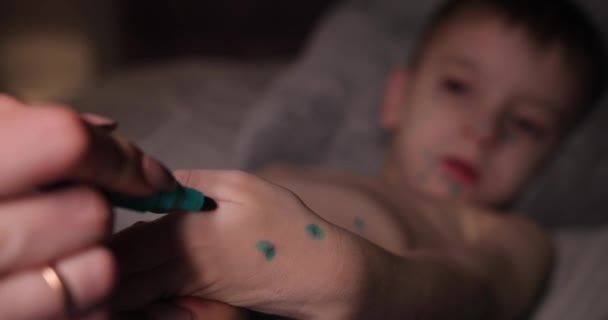 子供の手に女性がドットマーカーを緑に置きます。水痘を患っている赤ちゃんがベッドの上に横たわっています。水痘の治療法です。水痘のにきびがはっきりと見えます — ストック動画