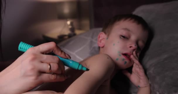 Geen gelukkige jongen ziek met waterpokken ligt in bed aan zijn kant. moeder zet een marker groene tante op puistjes van waterpokken — Stockvideo