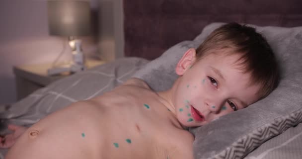 病気の赤ん坊は目を閉じてベッドの上に横たわっている。緑の点を持つ子供の体にあります。子供は疲れてる. — ストック動画